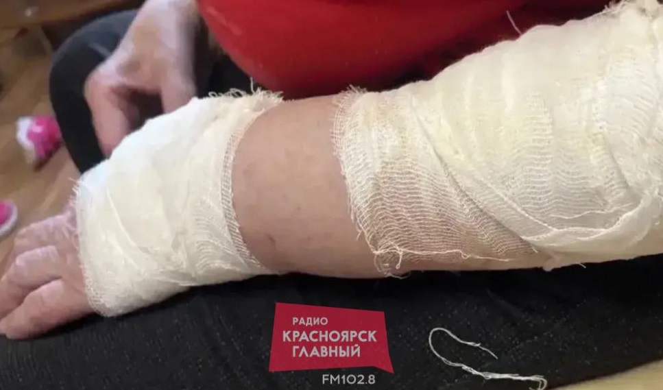 Полицейские ищут владельца собаки, которая покусала пенсионерку в магазине на Гладкова